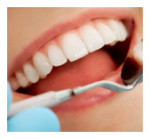 dental prophylaxis in Royse